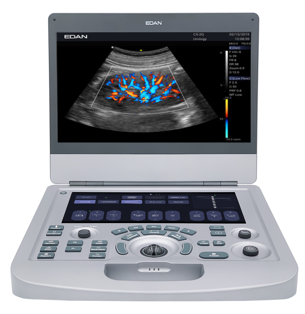 EDAN Acclarix AX3 Compact Ultrasound System | DiaMedical USA